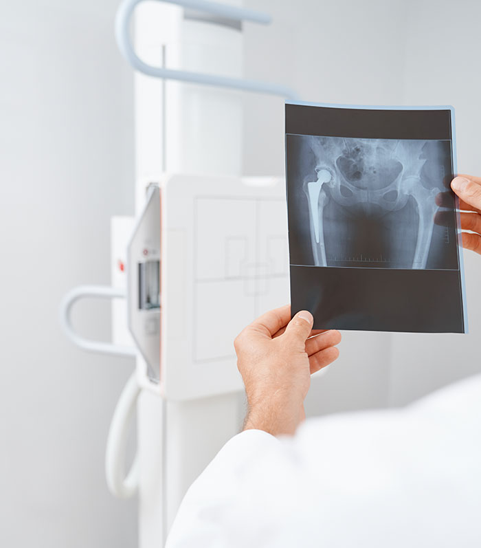 Rayos X (fijo y móvil)